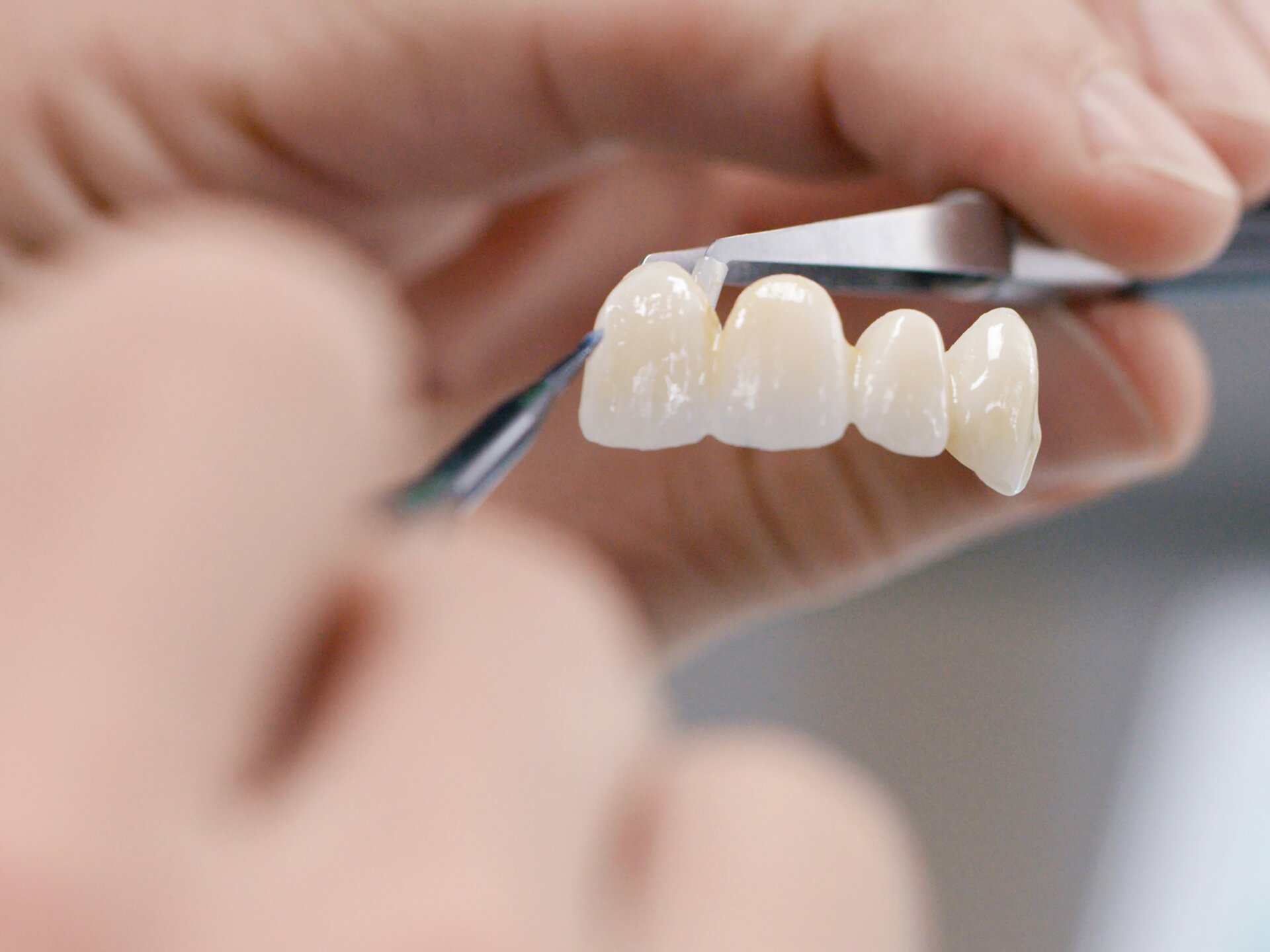 Zirconia Restorations Workflow Ivoclar